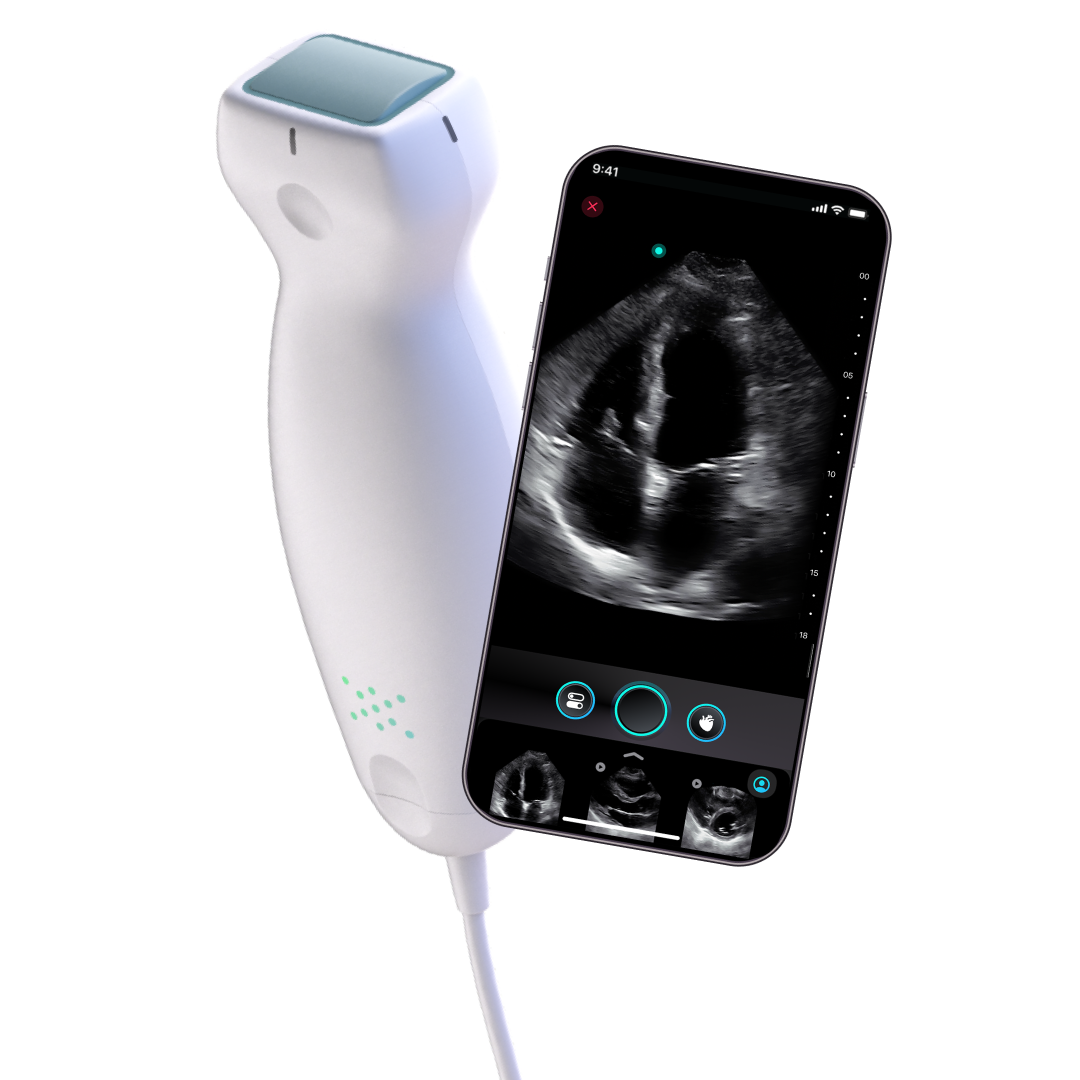 Exo Iris sonda POCUS con imagen cardíaca en iPhone